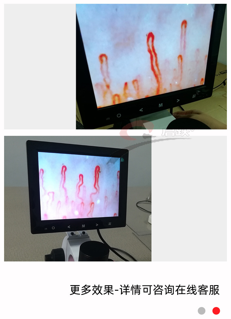 广州启跃qy990高清微循环检测仪末梢血管观察显像仪看手指显微镜