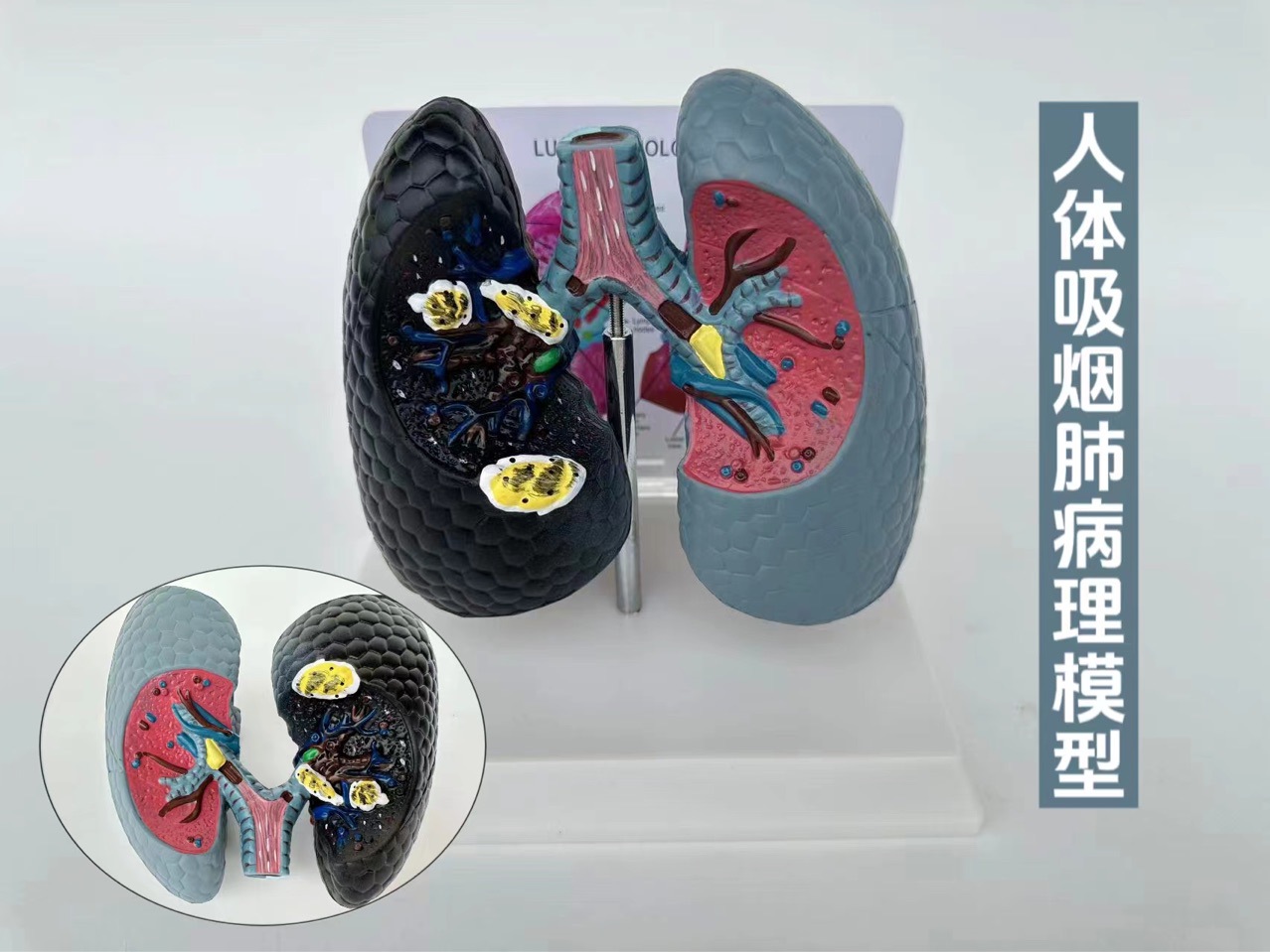 人体吸烟癌变肺模型 健康肺模型人类内脏 吸烟肺与健康肺模型