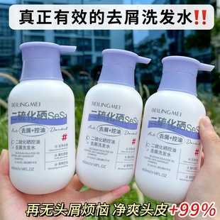 Bei Lingmei дисульфид селен для борьбы с перхотью шампунь для очистки волосяных фолликулов