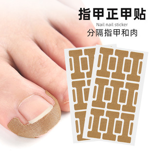 Orthopedic nail paste nail groove roll adjustment stretch no glue inlay nail toe pad nail orthopedic mix and match patch