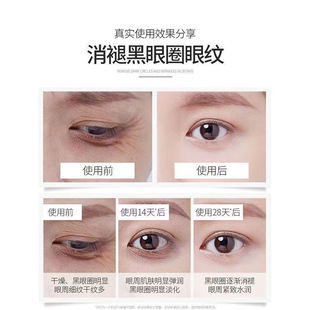 ultrasonic scalpel eye cream wrinkle firming eye care fade eye fine lines anti-wrinkle eye cream bags under the eyes dark circles