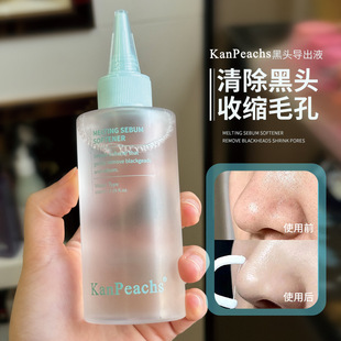 Blackhead Lead Liquid Gentle Oil Control Convergence Pore to Blackhead and Comedone Wet Dossing Strawberry Nose Deep Cleansing Artifact