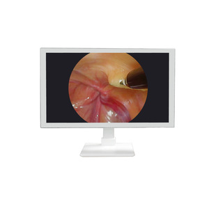 Medical monitor 24 inch 27 inch 32 inch endoscope camera system monitor screen resolution high picture