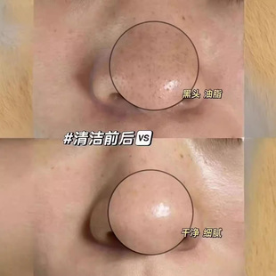 Hair follicle purification cream for beauty salon Pore Acne Cleansing Cream blackhead removing cutin massage cream facial blackhead stickers