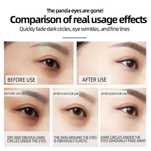 Collagen Polypeptide Eye Essence and Eye Cream High-end Cinemas to Desalinate Dark Circles and Brighten and Tight Eye Circumstances