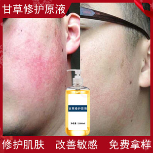 Licorice Repair Essence for Soothing Skin to Bloodshot After Sun Damage Sensitive Skin Hormone Face Repair Essence