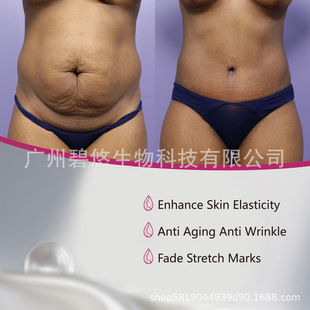 Stretch mark oil enhance skin elasticity anti aging low moq