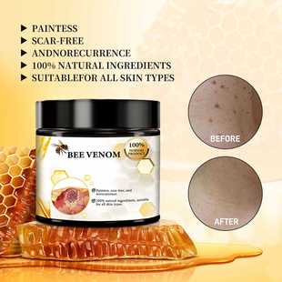 Крем для ухода за кожей от трансграничного пчелиного яда BEE VENOM для восстановления кожи рук и ног мох Увлажняющий крем для сглаживания кожи 60 г