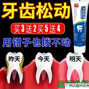 Tooth loosening gingival swelling and pain root exposure gingival tooth fixation tooth care anti-tooth decay toothpaste yellow tooth removal home generation