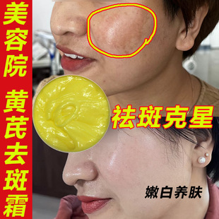 Beauty Salon Astragalus Cream genuine goods Veteran Chinese Brightening Skin Whitening Melanin Removal Drawing Melasma Removal Cream