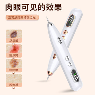 2022 New Dot Mole Pen Beauty Salon Mole Removal Traceless Face Removal Household Laser Spot Removing Instrument Spot Sweeping Pen Artifact