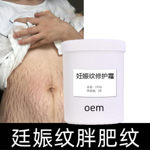 Stretch Mark Repair Cream to Reduce Postpartum Obesity Marks and Growth Marks, Care and Beauty Salon Line, Nourishing Processing and Customization