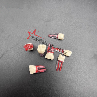 Dental with Tooth Root Chalcedony Teeth Examination Practice Chalcedony Escalant Teeth with Tooth Root Chalodontic Root Canal Tooth Particles Practice