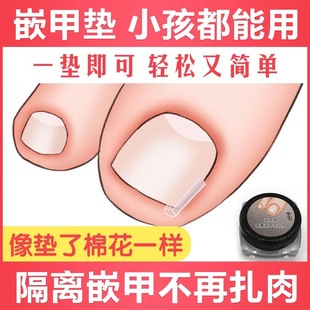 Inlay nail filler nail pad nail groove toenail long meat filling strip plastic nail wire orthosis wholesale