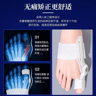 Thumb valgus internal buckle medical grade toe corrector for children and adults day and night male and female foot corrector