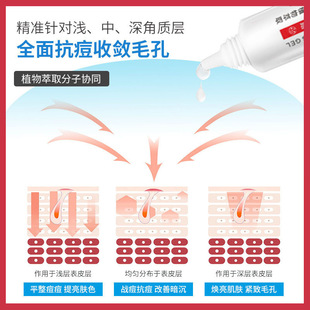 Фу Шитинг Ренрендин 20% Qingmyang Nelu крем от прыщей разбавляет следы от прыщей и восстанавливает мышцы от прыщей