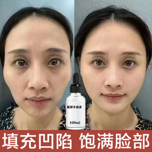 Facial Plumping Liquid, Plump Temples Filling, Facial Sunken Removal, Tear Troughs, Nasolabial Folds, Forehead Wrinkles, Wrinkle Removal and Filling Liquid