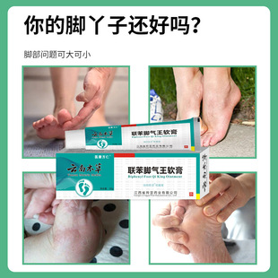 Yunnan Materia Medica Бензол Бензол Ван Тангеназол Мазь зуд ног