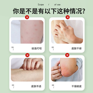 Xinbai Mukang Юньнань Duiyang Wang мазь от укусов комаров зуд и антибактериальная Очищающая мазь источник производитель