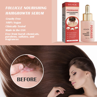 EELHOE Moss Hair Nourishing Essence Deep Cleansing Scalp Anti-dandruff Anti-itching Refreshing Dense Hair Care Solution