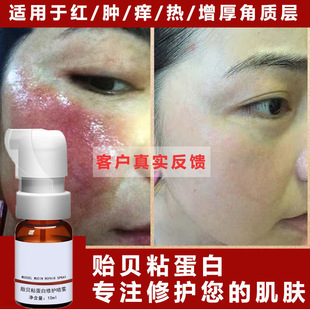 Mussel Sticky Serum Protein Repair Spray Sensitive Muscle Red Blood Thread Hormone Face Red Essence Spray