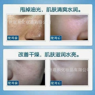 Hyaluronic Acid Liquid High Concentration Brightening Skin Color Hyaluronic Acid Essence Hydrating Moisturizing Water Light Liquid Beauty Salon