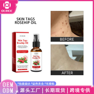 OUHOE Rosehip Seed Clover Essence Oil Skin Label Repair Fade Mole Eyelet Meat Extract