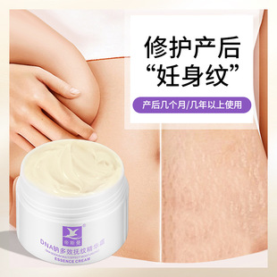 Fat Wrinkle Repair Cream, Non-Removal of Fat Wrinkles, Growth Wrinkles, Pregnant Women, Postpartum Wrinkles, Firming Belly and Thighs, Lightening