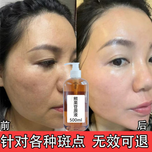Arbutin stock solution brightening skin color spot fading spot removing melasma freckles beauty salon spot removing brightening essence