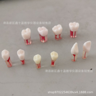 Dental root canal model oral skills test students practice open pulp root canal repair in vitro tooth resin tooth