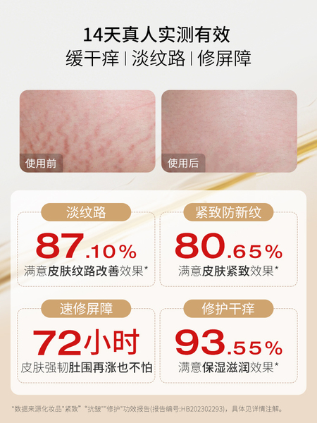 德国嫩芙橄榄妊娠油备孕妇女预防淡化肥胖纹用嫩肤妊辰身体精华油 — 2