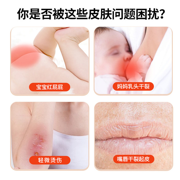 纯正蛋黄油婴儿孕妇专用哺乳期乳头干裂鸡蛋油宝宝红屁股护臀膏 — 2