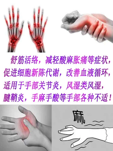 Служба с сухожилищами.