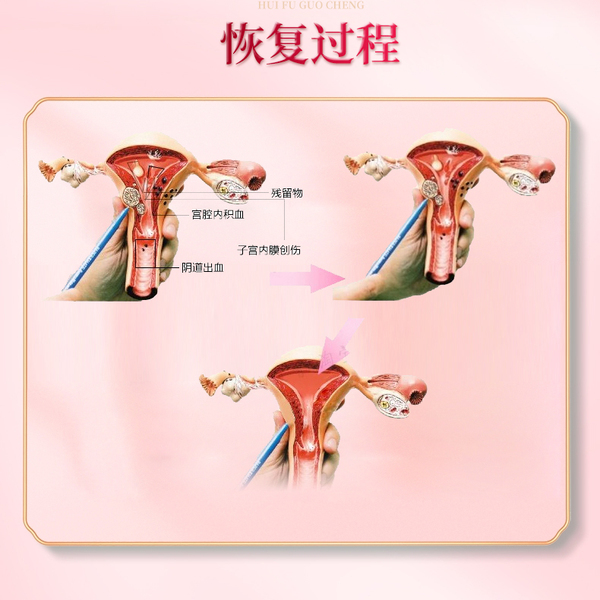 小产后小月子人流后调理补品小月子水子宫恶露营养品修复护理恢复 — 5
