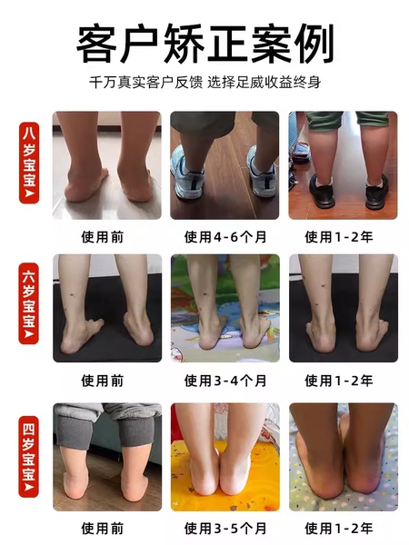 儿童扁平足纠正凉鞋内外八字矫正机能鞋宝宝足外翻踮脚足弓支撑器 — 4