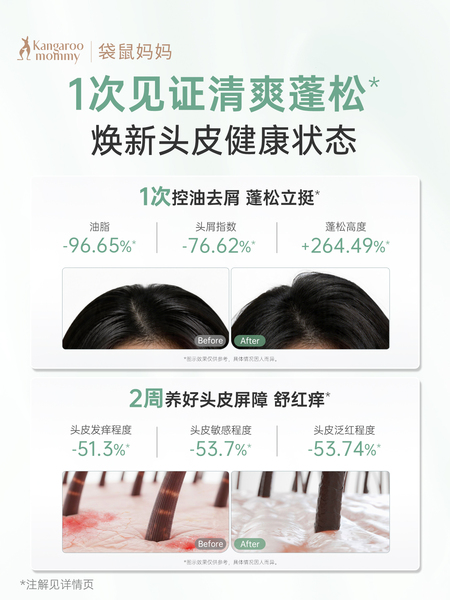 袋鼠妈妈洗发水蓬松控油洗发露备孕洗护套装妇女专用护肤清洁保湿 — 4