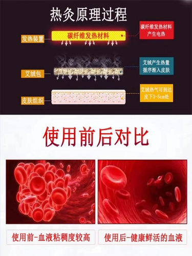 Служба с сухожилищами.