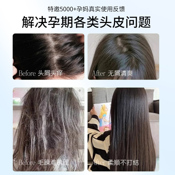 准孕妇期洗发水专用去屑控油蓬松可用沐浴露护发素套装洗头发膏露 — 5