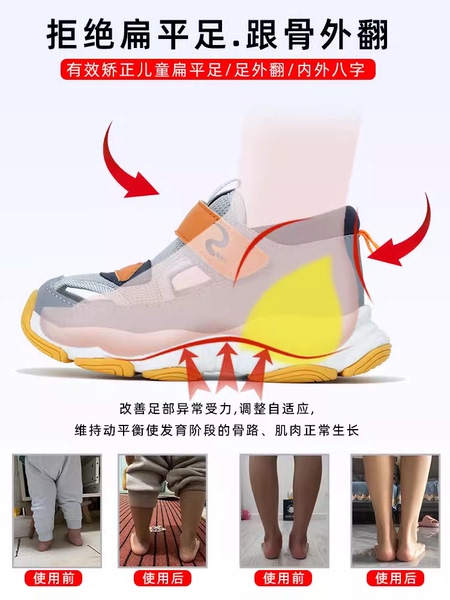 儿童扁平足纠正凉鞋内外八字矫正机能鞋宝宝足外翻踮脚足弓支撑器 — 3