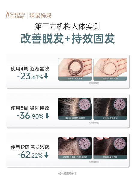 袋鼠妈妈防脱洗发水控油去屑专用生姜养发固发洗发露正品旗舰店 — 4
