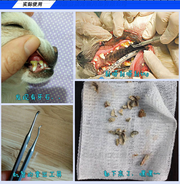 牙石工具1_04
