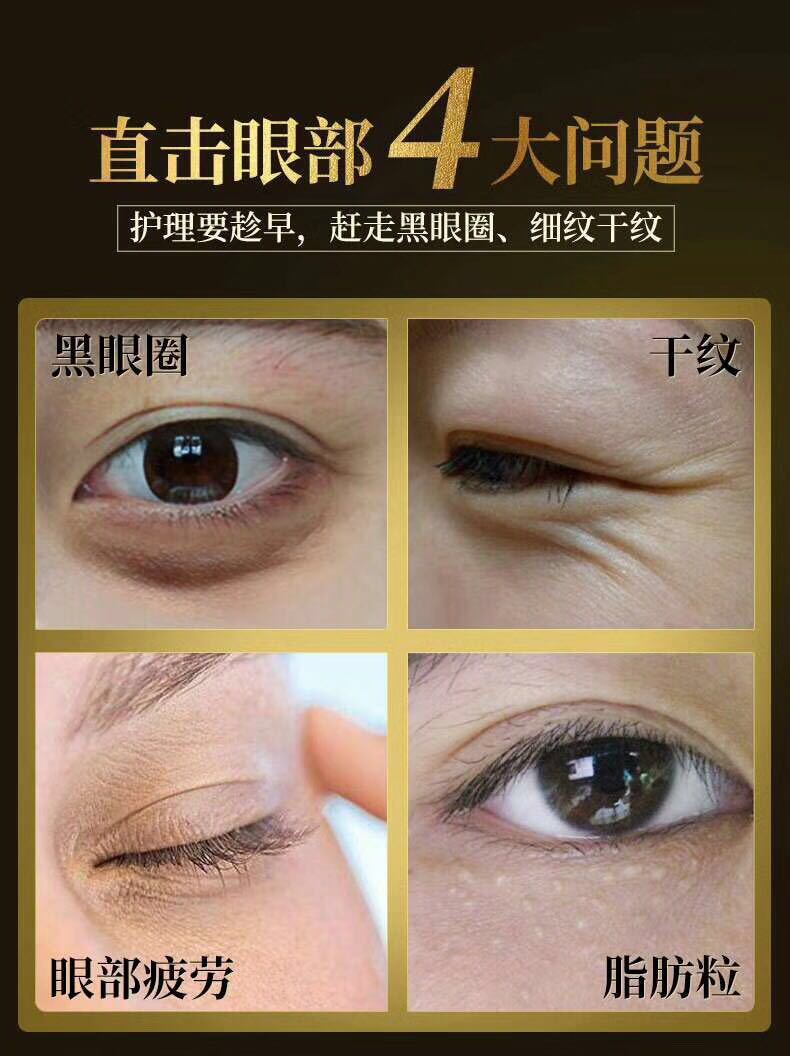 LANKOUO黑珍珠眼膜