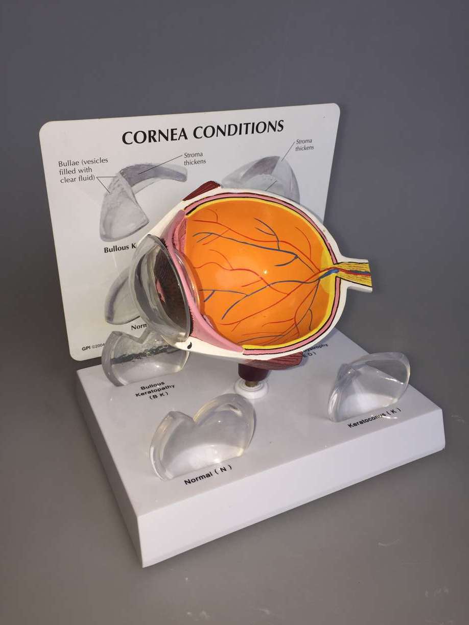 角膜病模型1