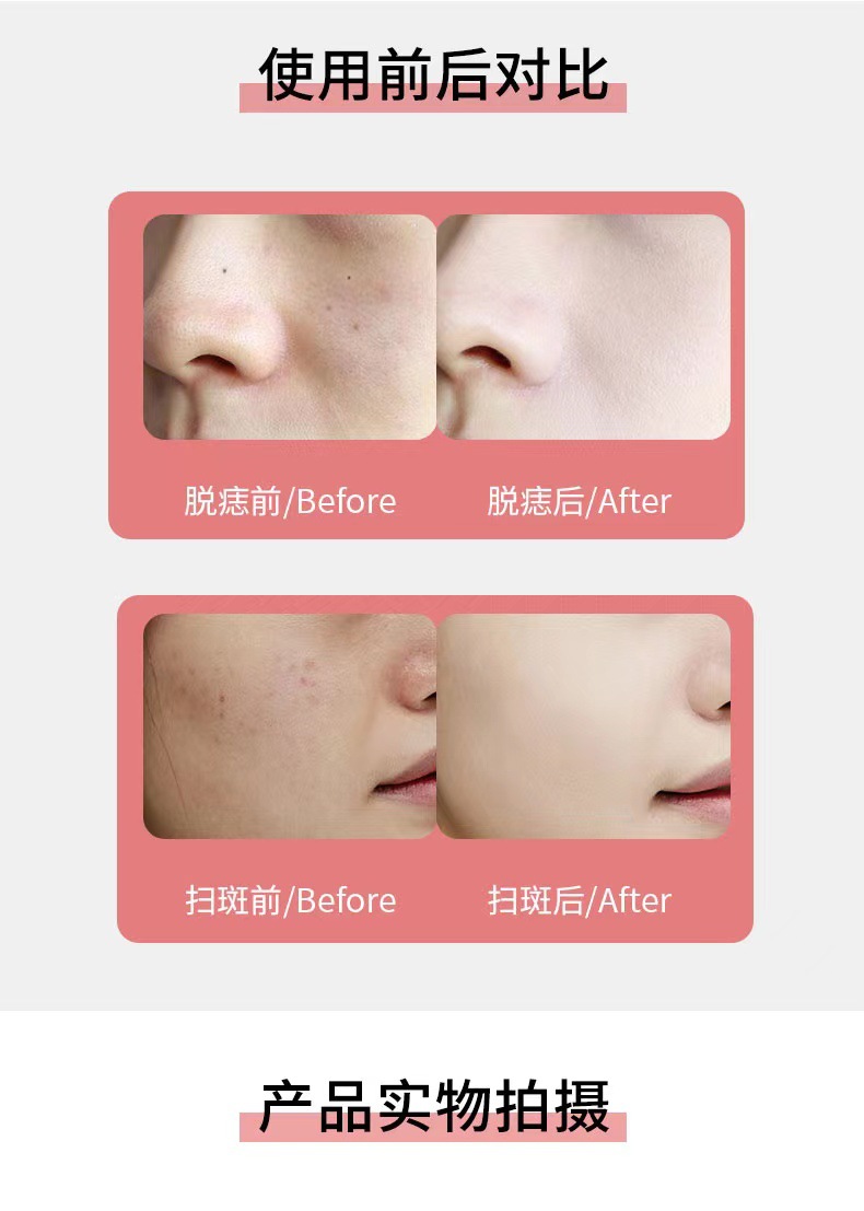 点斑机详情10