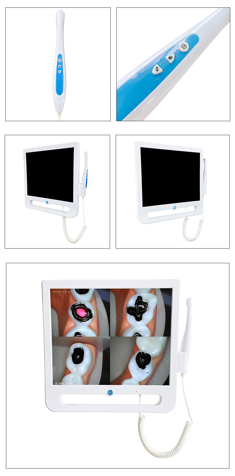 口腔观察仪_16