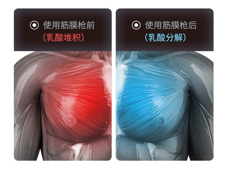 冷敷筋膜枪七彩呼吸灯电动液晶款肌肉经络保健运动健身