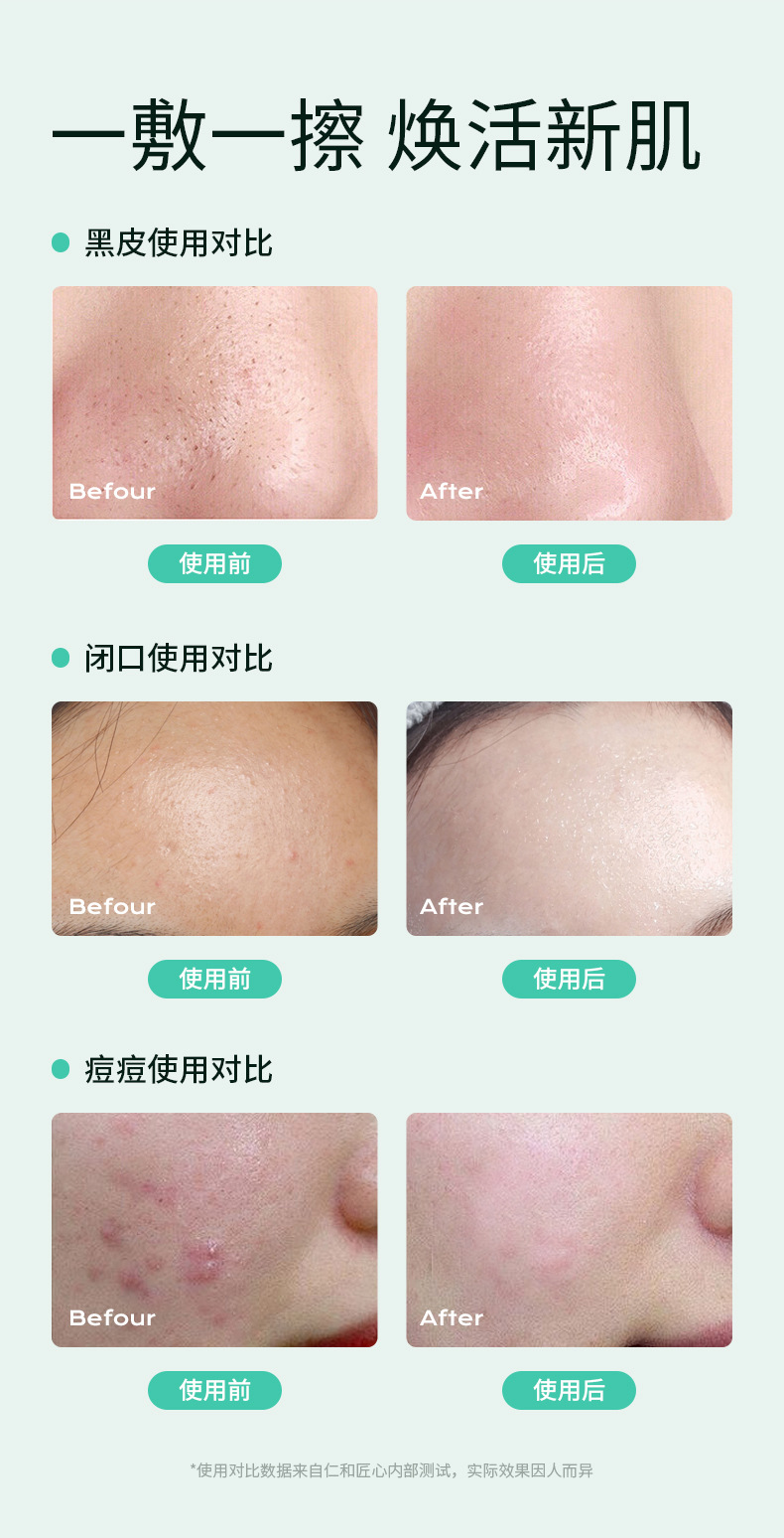 仁和复合水杨酸祛痘焕肤棉片(粉绿款)详情_10