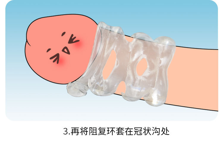 镂空包皮阻复环750_08