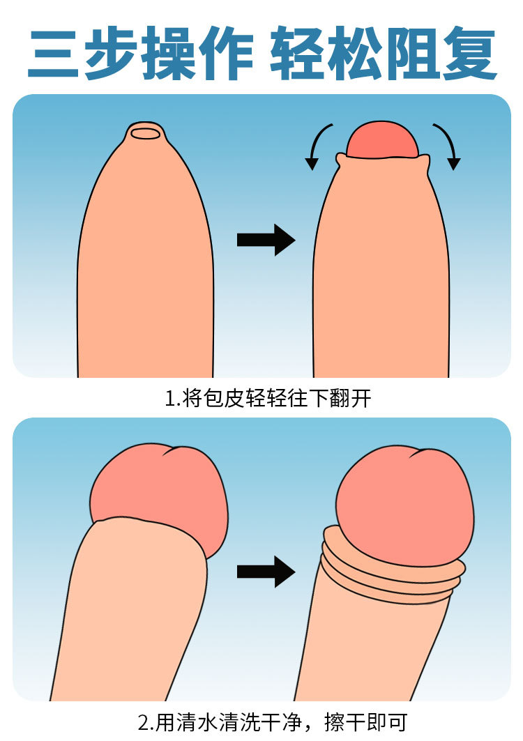 镂空包皮阻复环750_07