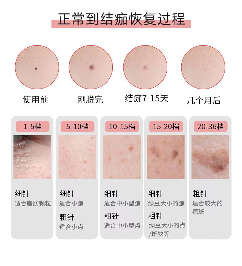 点斑机详情9